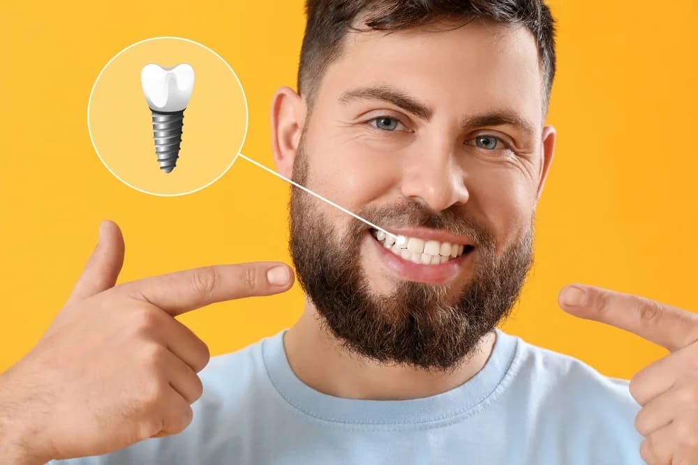 Implante dentário — Clínica Mariela Baltazar