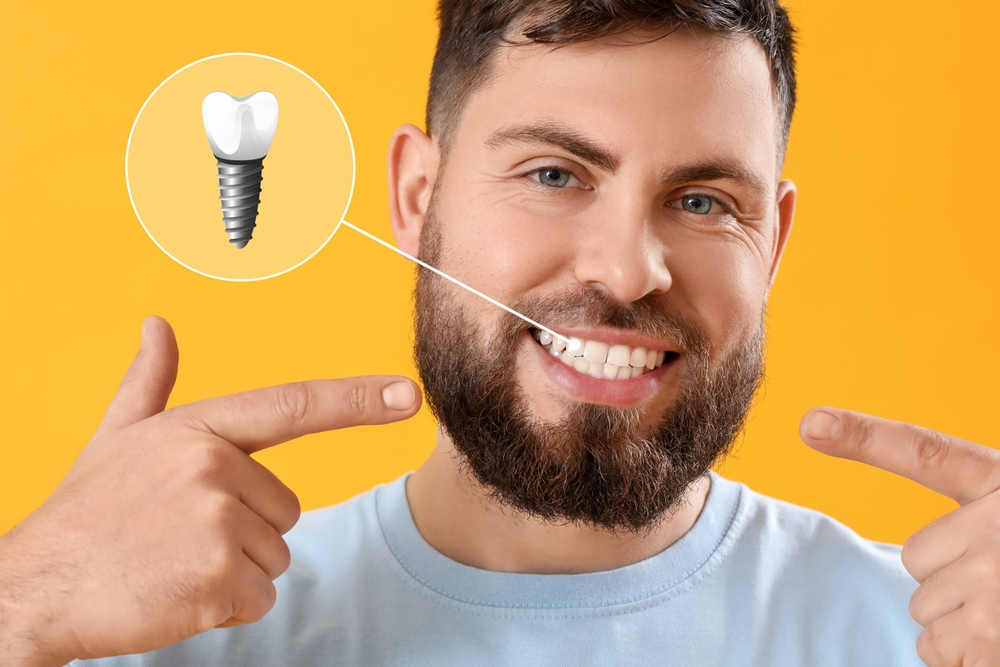 Implantes dentários realizados pela Dra. Mariela Baltazar no Tatuapé e Mooca
